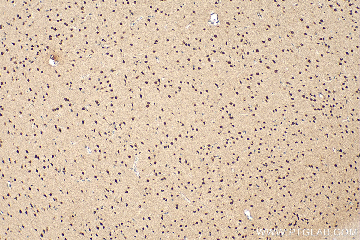 Immunohistochemistry (IHC) staining of rat brain tissue using CHD2 Polyclonal antibody (21334-1-AP)