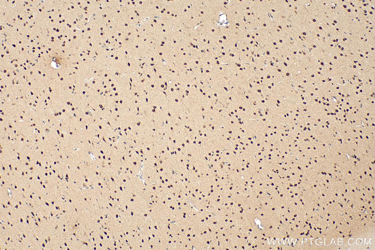 Immunohistochemistry (IHC) staining of rat brain tissue using CHD2 Polyclonal antibody (21334-1-AP)