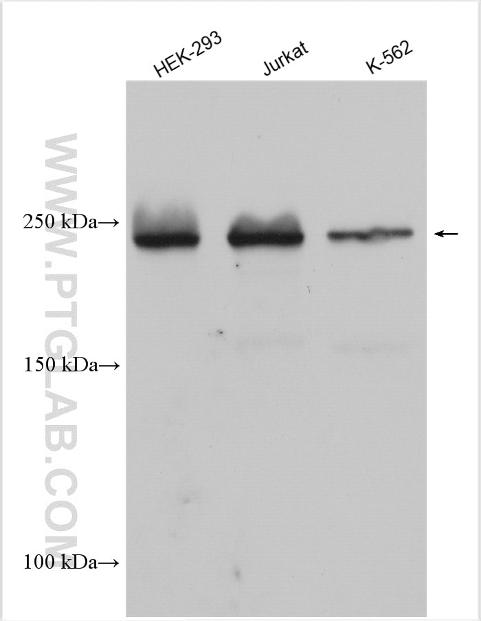 Western Blot (WB) analysis of various lysates using CHD2 Polyclonal antibody (21334-1-AP)