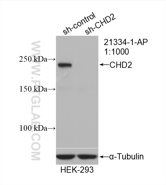 Western Blot (WB) analysis of HEK-293 cells using CHD2 Polyclonal antibody (21334-1-AP)