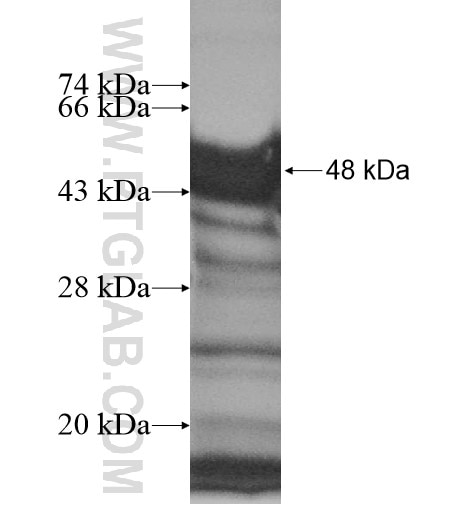 CHD2 fusion protein Ag15429 SDS-PAGE