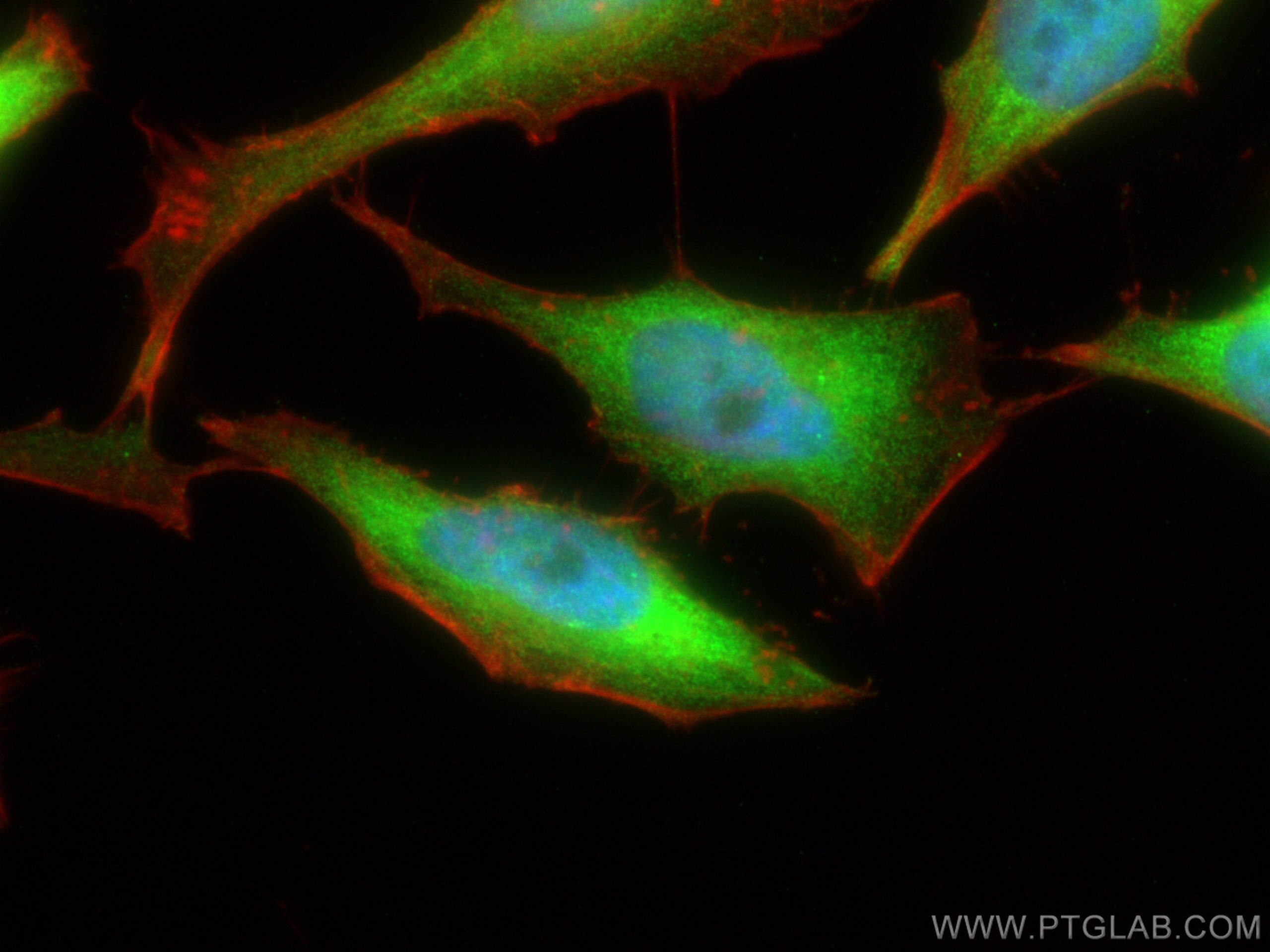 Immunofluorescence (IF) / fluorescent staining of HeLa cells using CHD3 Polyclonal antibody (25335-1-AP)