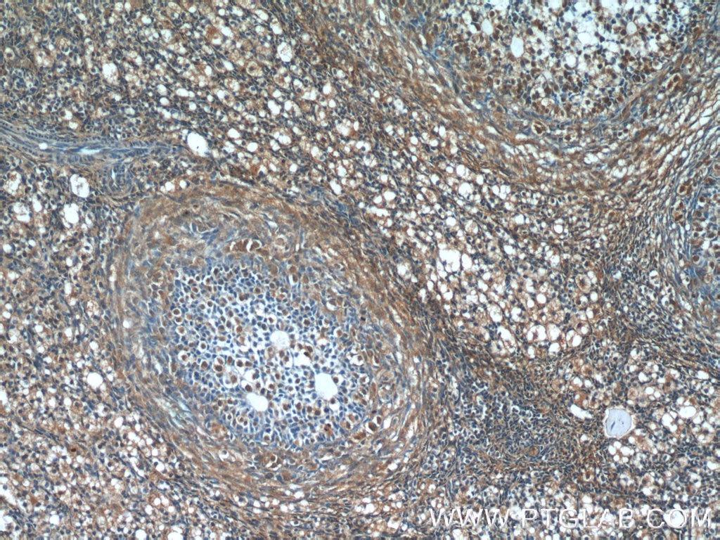 Immunohistochemistry (IHC) staining of human ovary tissue using CHD3 Polyclonal antibody (25335-1-AP)