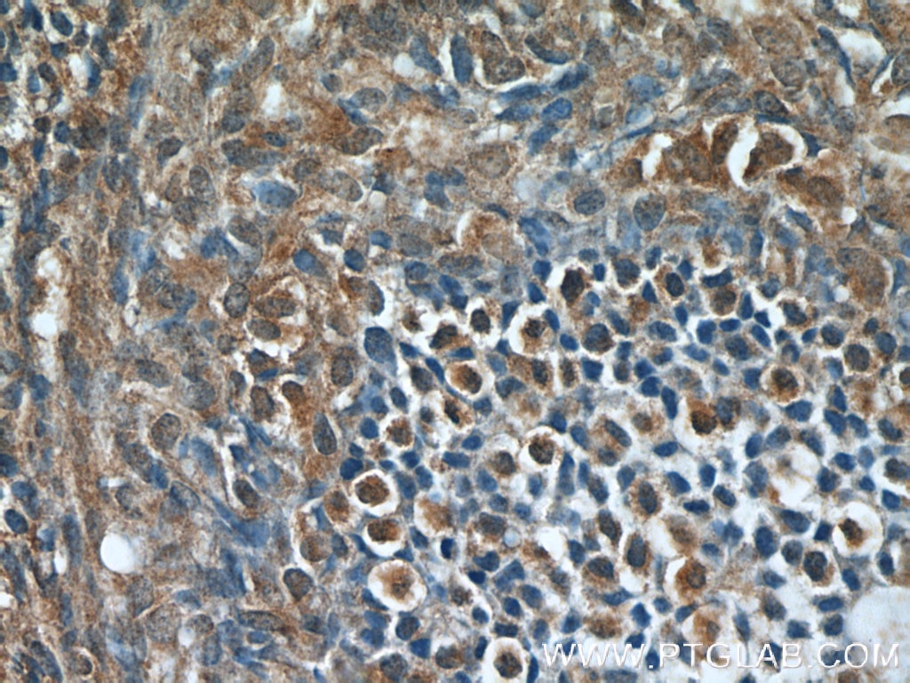 Immunohistochemistry (IHC) staining of human ovary tissue using CHD3 Polyclonal antibody (25335-1-AP)