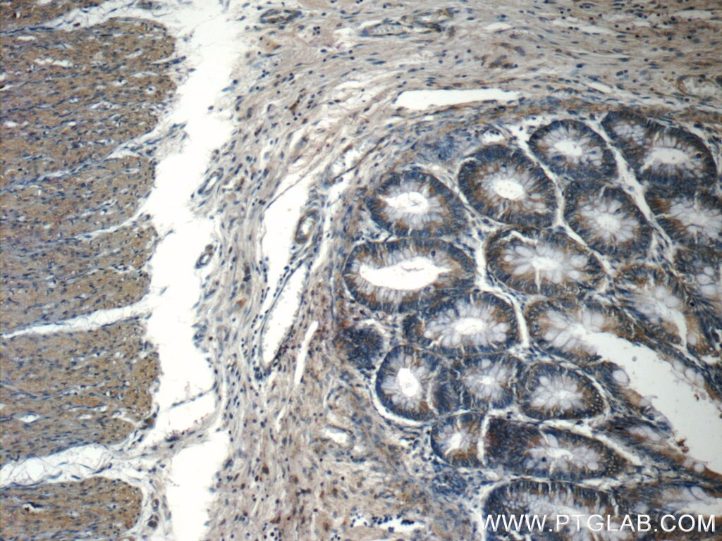 Immunohistochemistry (IHC) staining of human colon tissue using CHD3 Polyclonal antibody (25335-1-AP)