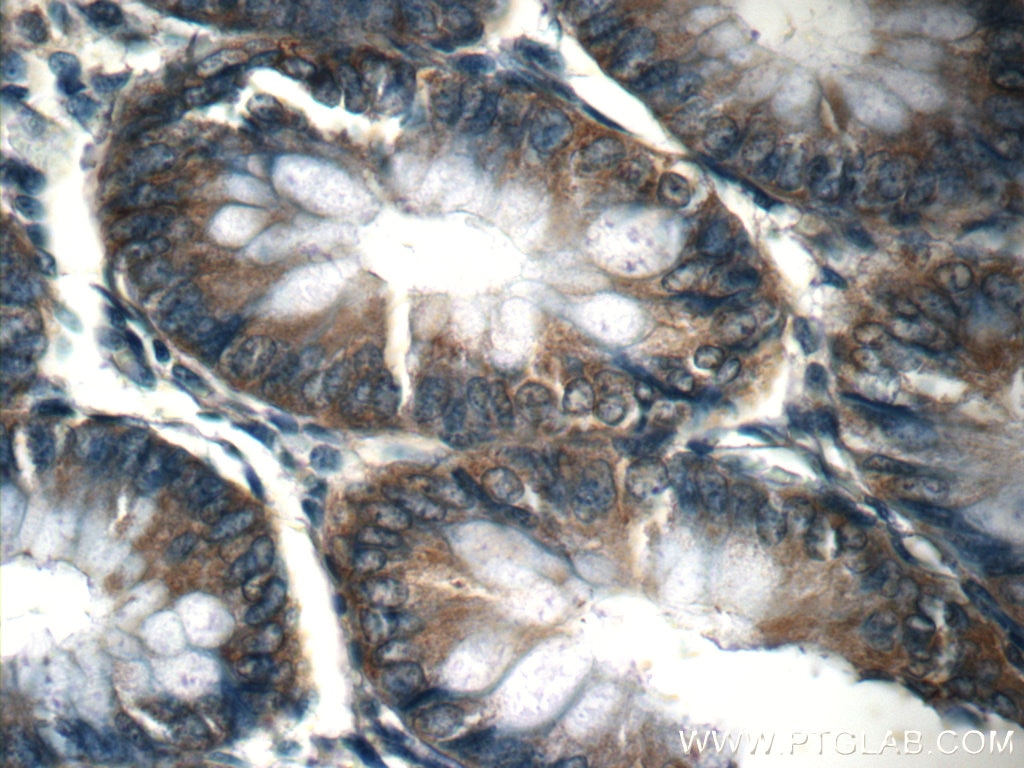 IHC staining of human colon using 25335-1-AP