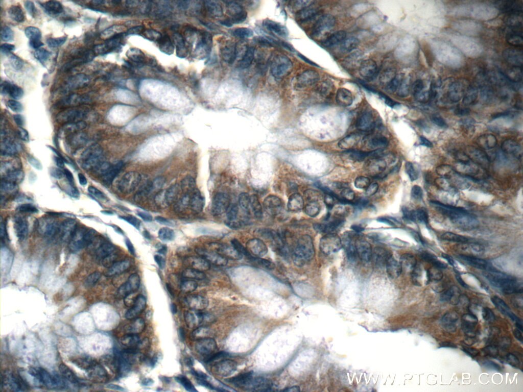 Immunohistochemistry (IHC) staining of human colon tissue using CHD3 Polyclonal antibody (25335-1-AP)