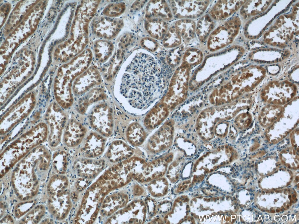 Immunohistochemistry (IHC) staining of human kidney tissue using CHD3 Polyclonal antibody (25335-1-AP)