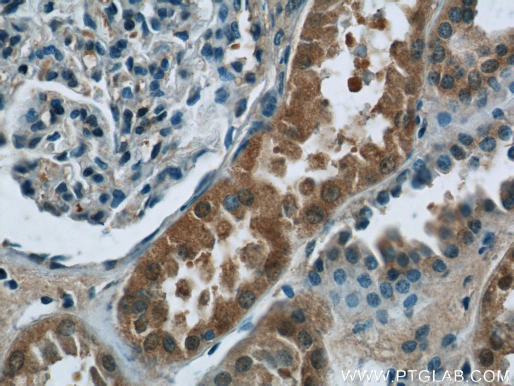 Immunohistochemistry (IHC) staining of human kidney tissue using CHD3 Polyclonal antibody (25335-1-AP)
