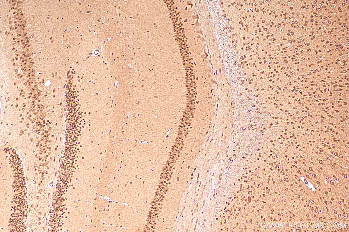 Immunohistochemistry (IHC) staining of mouse brain tissue using CHD3 Polyclonal antibody (25335-1-AP)