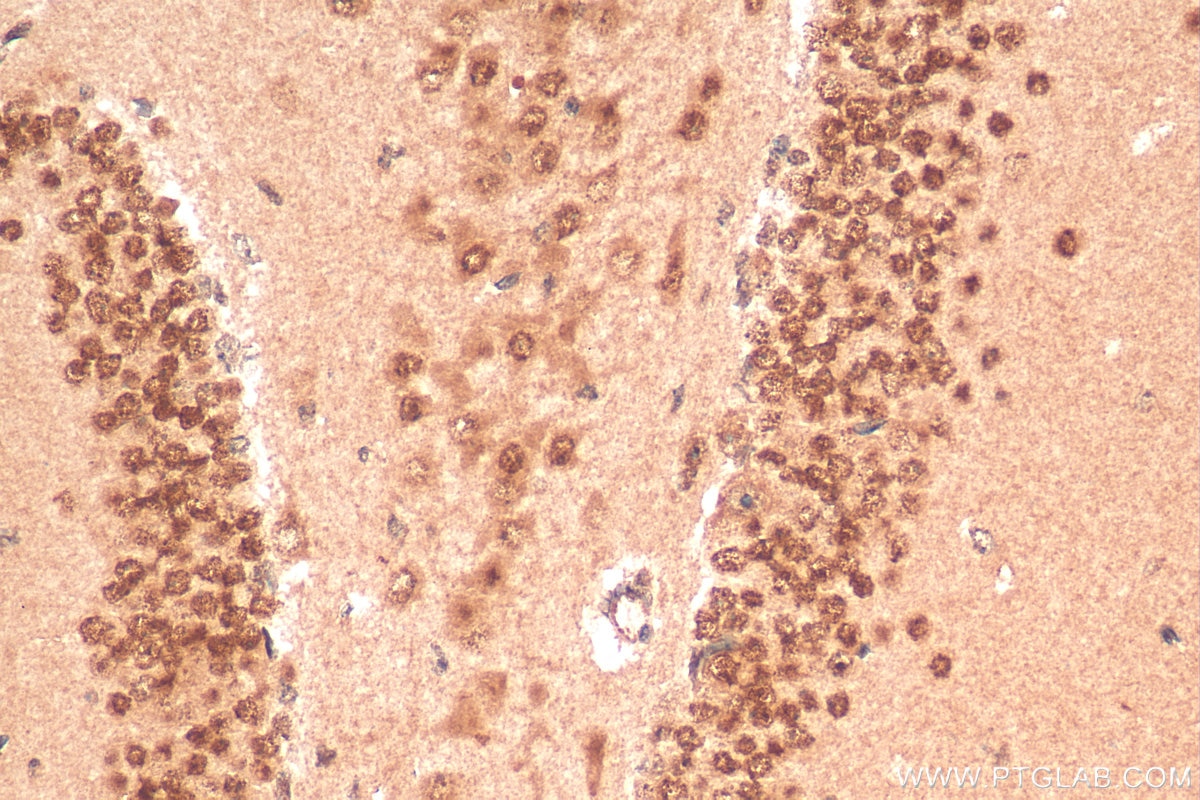 Immunohistochemistry (IHC) staining of mouse brain tissue using CHD3 Polyclonal antibody (25335-1-AP)
