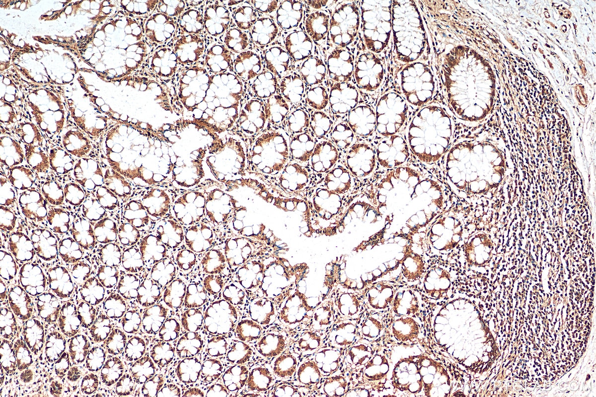 Immunohistochemistry (IHC) staining of human colon tissue using CHD3 Polyclonal antibody (25335-1-AP)