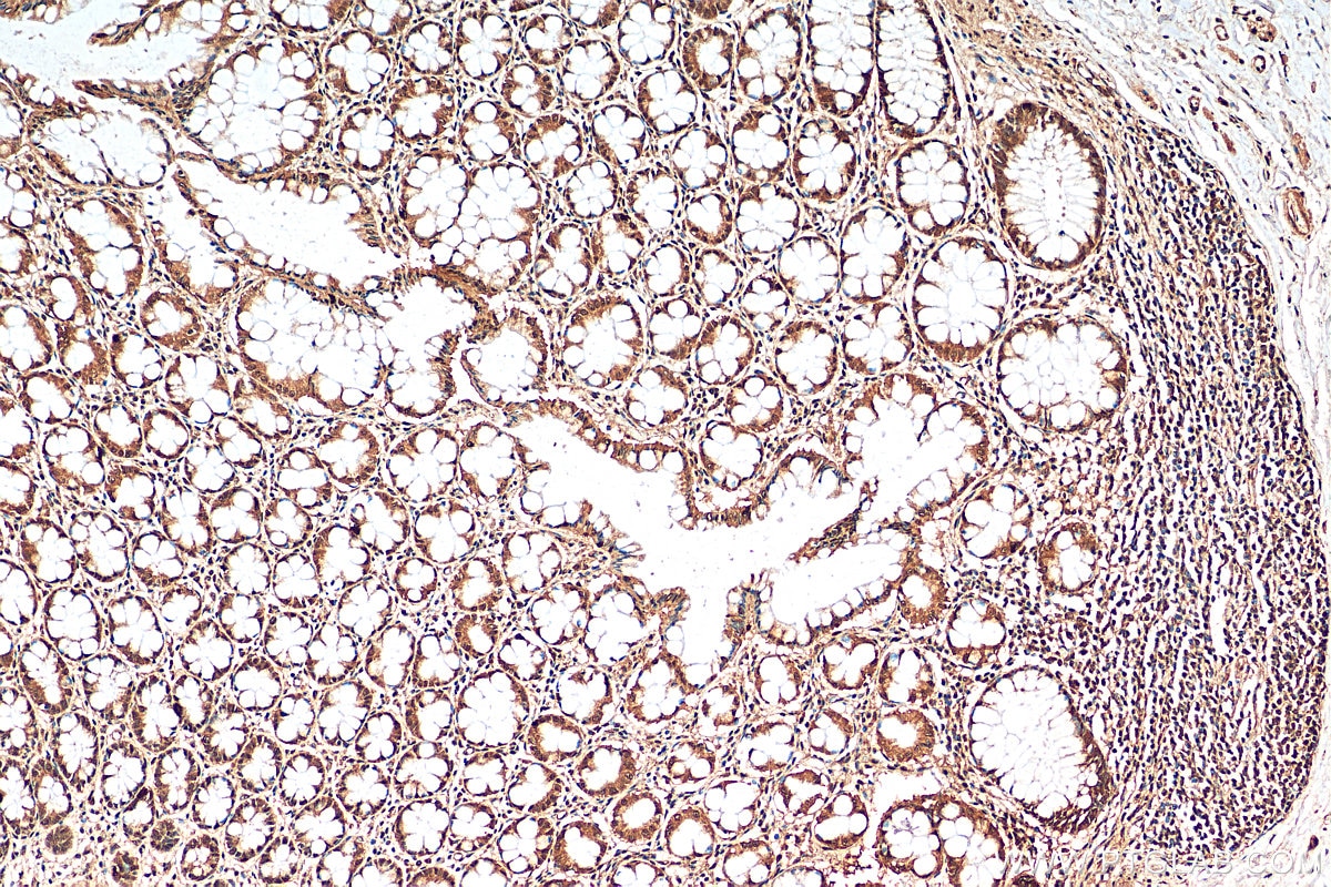 IHC staining of human colon using 25335-1-AP