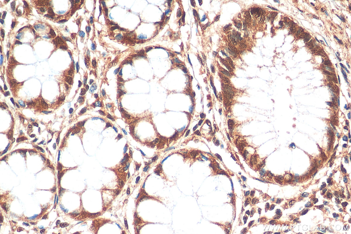 Immunohistochemistry (IHC) staining of human colon tissue using CHD3 Polyclonal antibody (25335-1-AP)