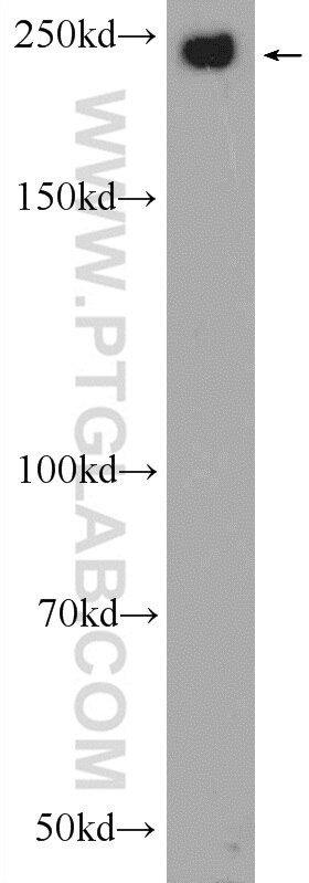 Western Blot (WB) analysis of HEK-293 cells using CHD3 Polyclonal antibody (25335-1-AP)