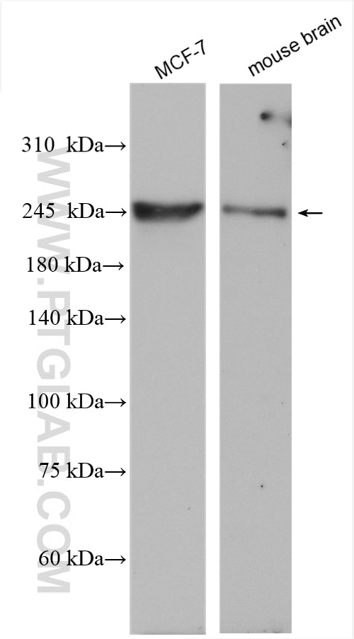 Western Blot (WB) analysis of various lysates using CHD3 Polyclonal antibody (25335-1-AP)