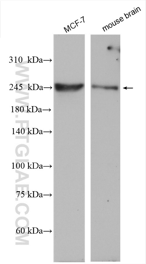 Western Blot (WB) analysis of various lysates using CHD3 Polyclonal antibody (25335-1-AP)