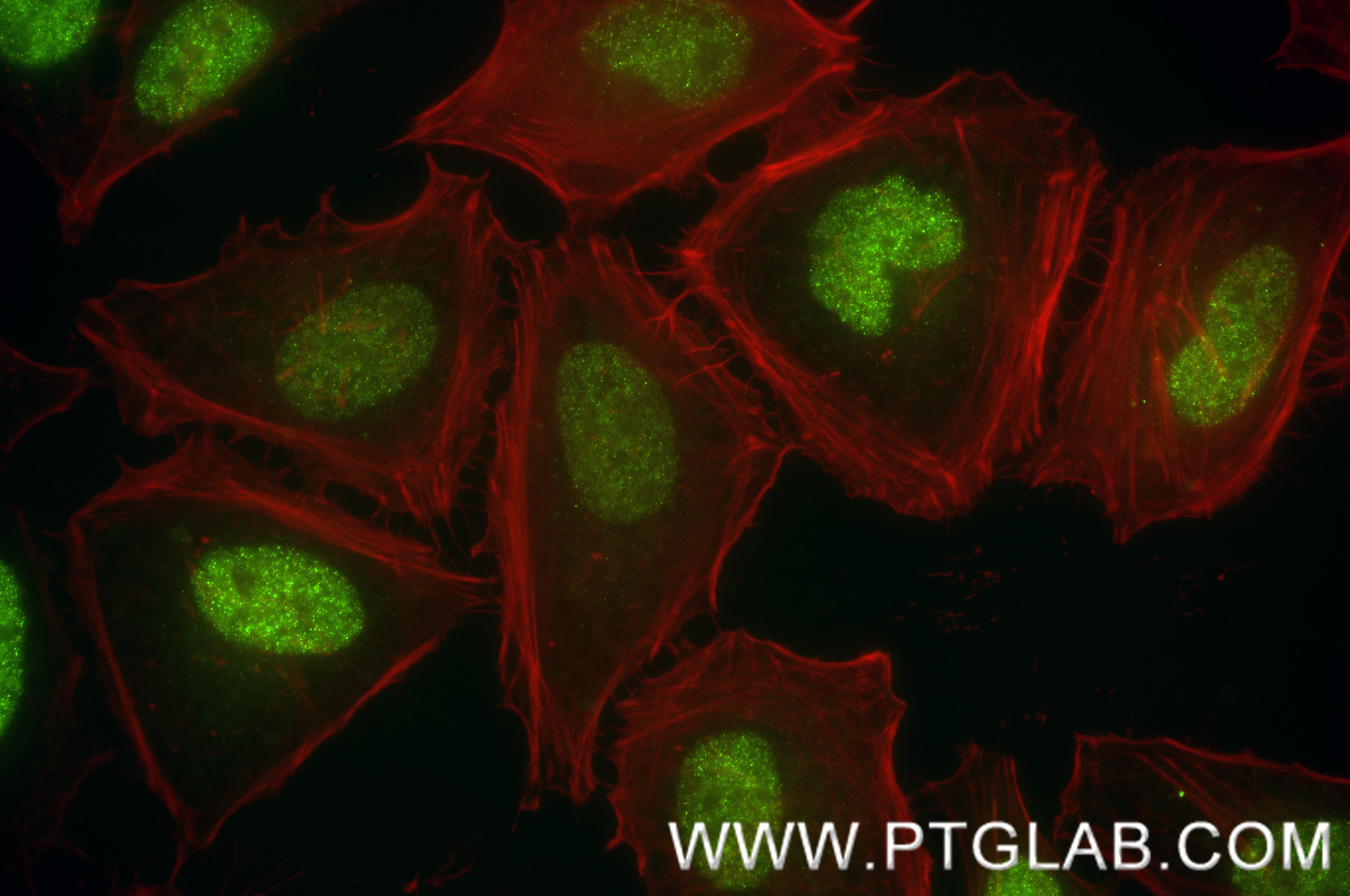 Immunofluorescence (IF) / fluorescent staining of HeLa cells using CHD3 Recombinant monoclonal antibody (86077-2-RR)