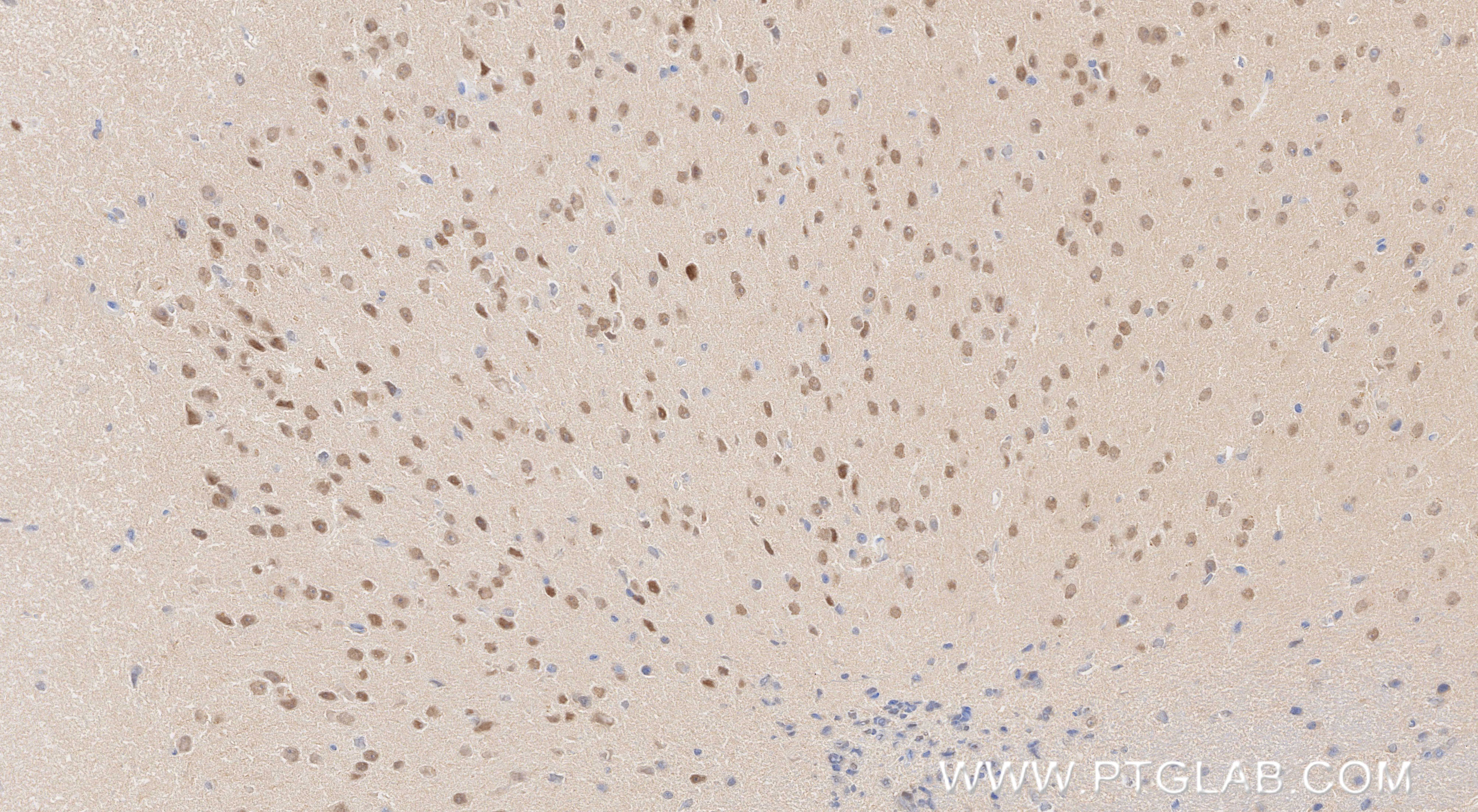 Immunohistochemistry (IHC) staining of mouse brain tissue using CHD3 Recombinant monoclonal antibody (86077-2-RR)