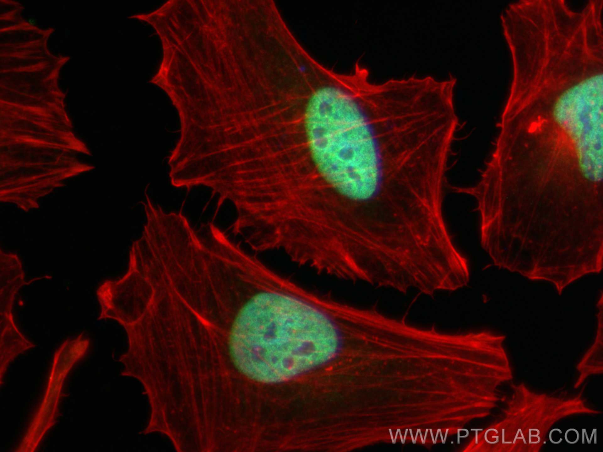 Immunofluorescence (IF) / fluorescent staining of HeLa cells using CHD4 Polyclonal antibody (14173-1-AP)