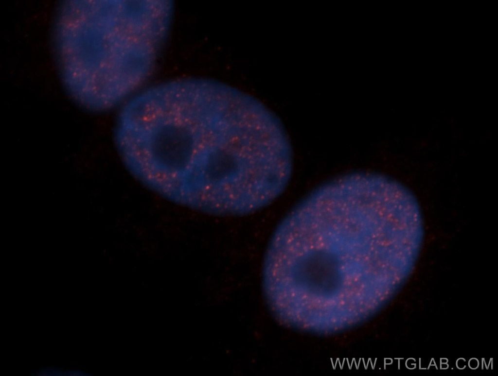 Immunofluorescence (IF) / fluorescent staining of A549 cells using CHD4 Polyclonal antibody (14173-1-AP)