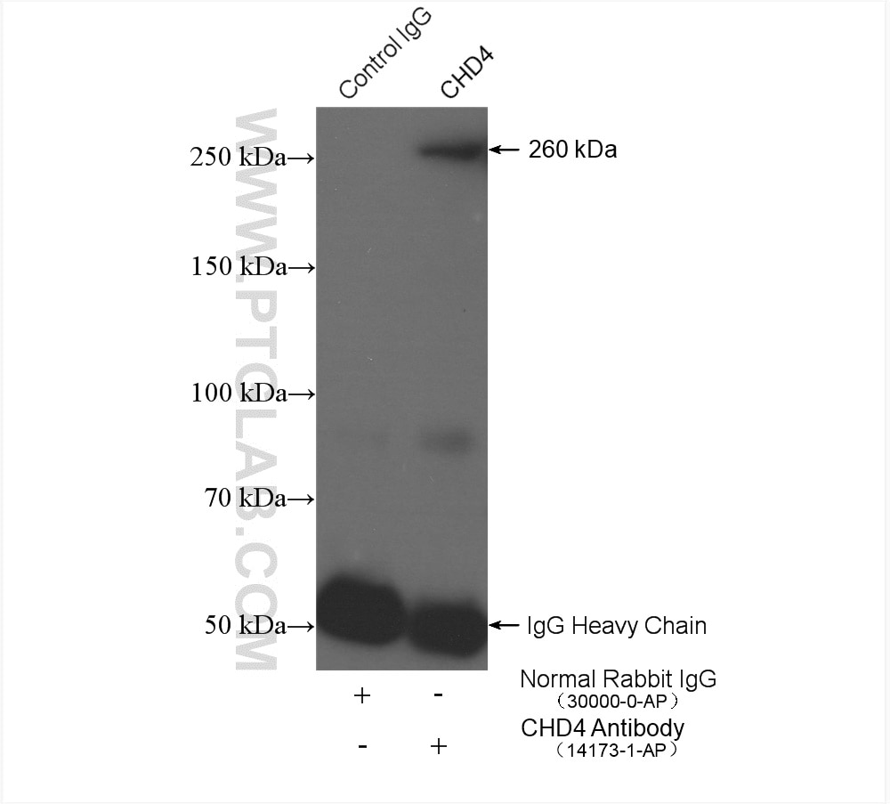 Immunoprecipitation (IP) experiment of HeLa cells using CHD4 Polyclonal antibody (14173-1-AP)