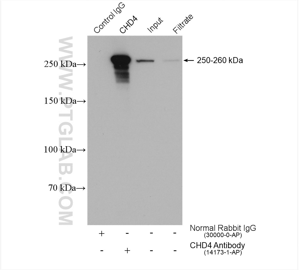 Immunoprecipitation (IP) experiment of HeLa cells using CHD4 Polyclonal antibody (14173-1-AP)