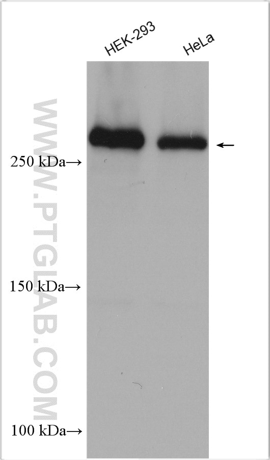 Western Blot (WB) analysis of various lysates using CHD4 Polyclonal antibody (14173-1-AP)