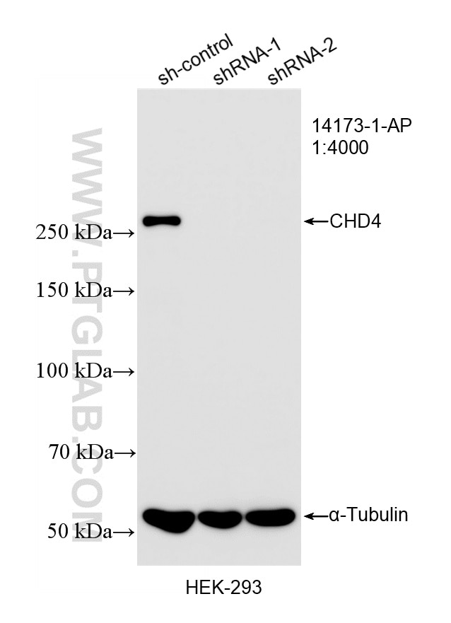 Western Blot (WB) analysis of HEK-293 cells using CHD4 Polyclonal antibody (14173-1-AP)