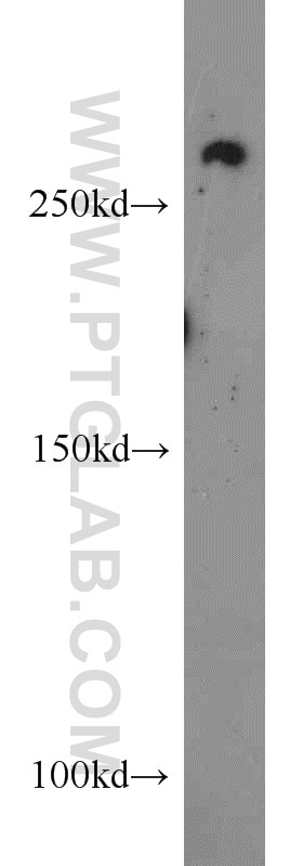 Western Blot (WB) analysis of HEK-293 cells using CHD4 Polyclonal antibody (14173-1-AP)