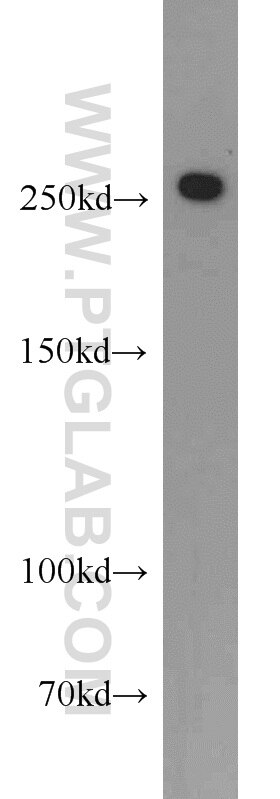 Western Blot (WB) analysis of HeLa cells using CHD4 Polyclonal antibody (14173-1-AP)