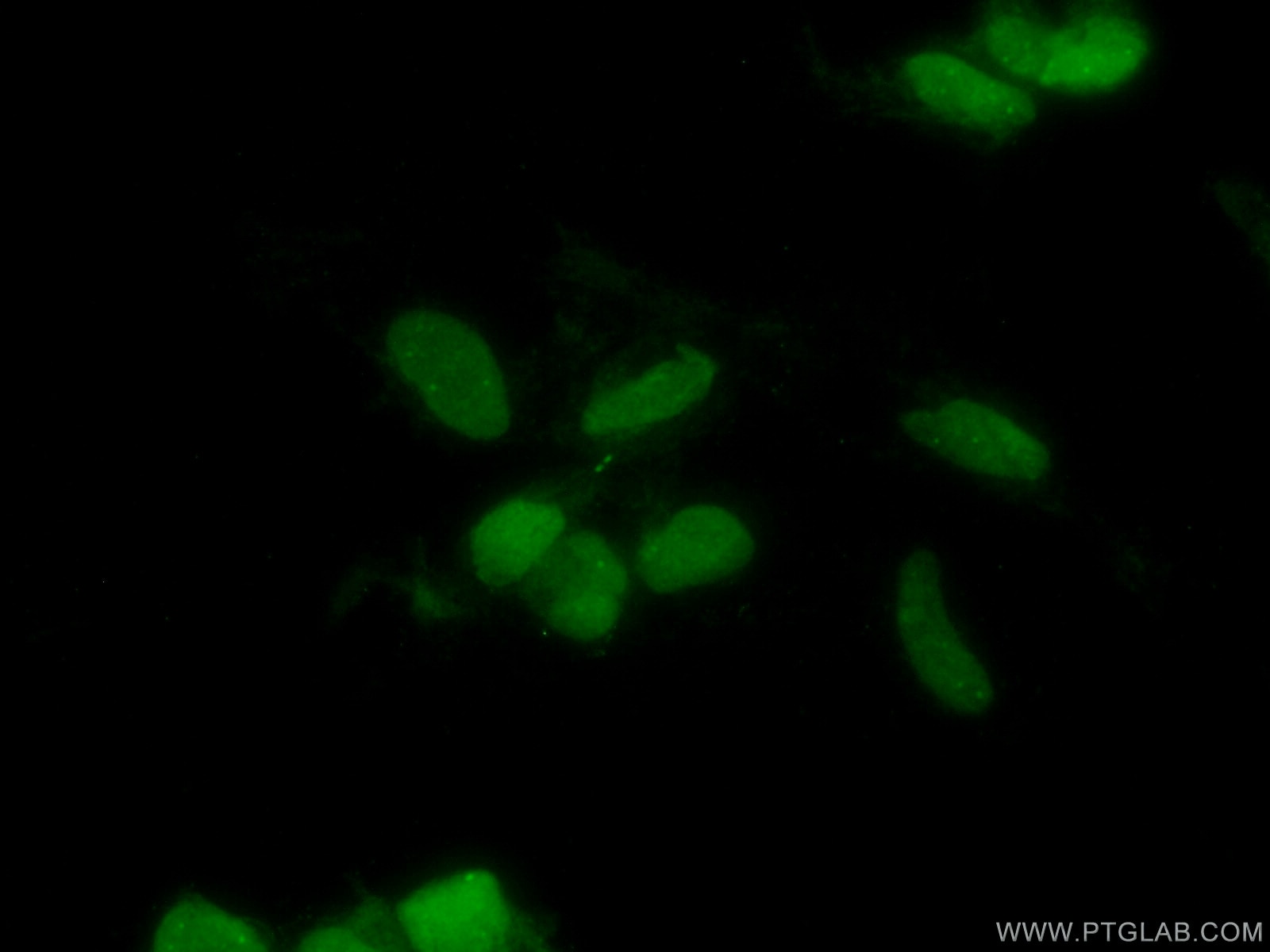 Immunofluorescence (IF) / fluorescent staining of HEK-293 cells using CHD4 Monoclonal antibody (66222-1-Ig)
