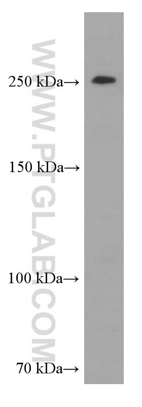 Western Blot (WB) analysis of HEK-293 cells using CHD4 Monoclonal antibody (66222-1-Ig)