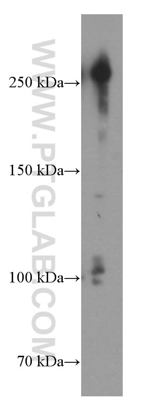 Western Blot (WB) analysis of HEK-293 cells using CHD4 Monoclonal antibody (66222-1-Ig)