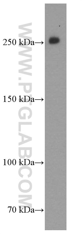 Western Blot (WB) analysis of MCF-7 cells using CHD4 Monoclonal antibody (66222-1-Ig)