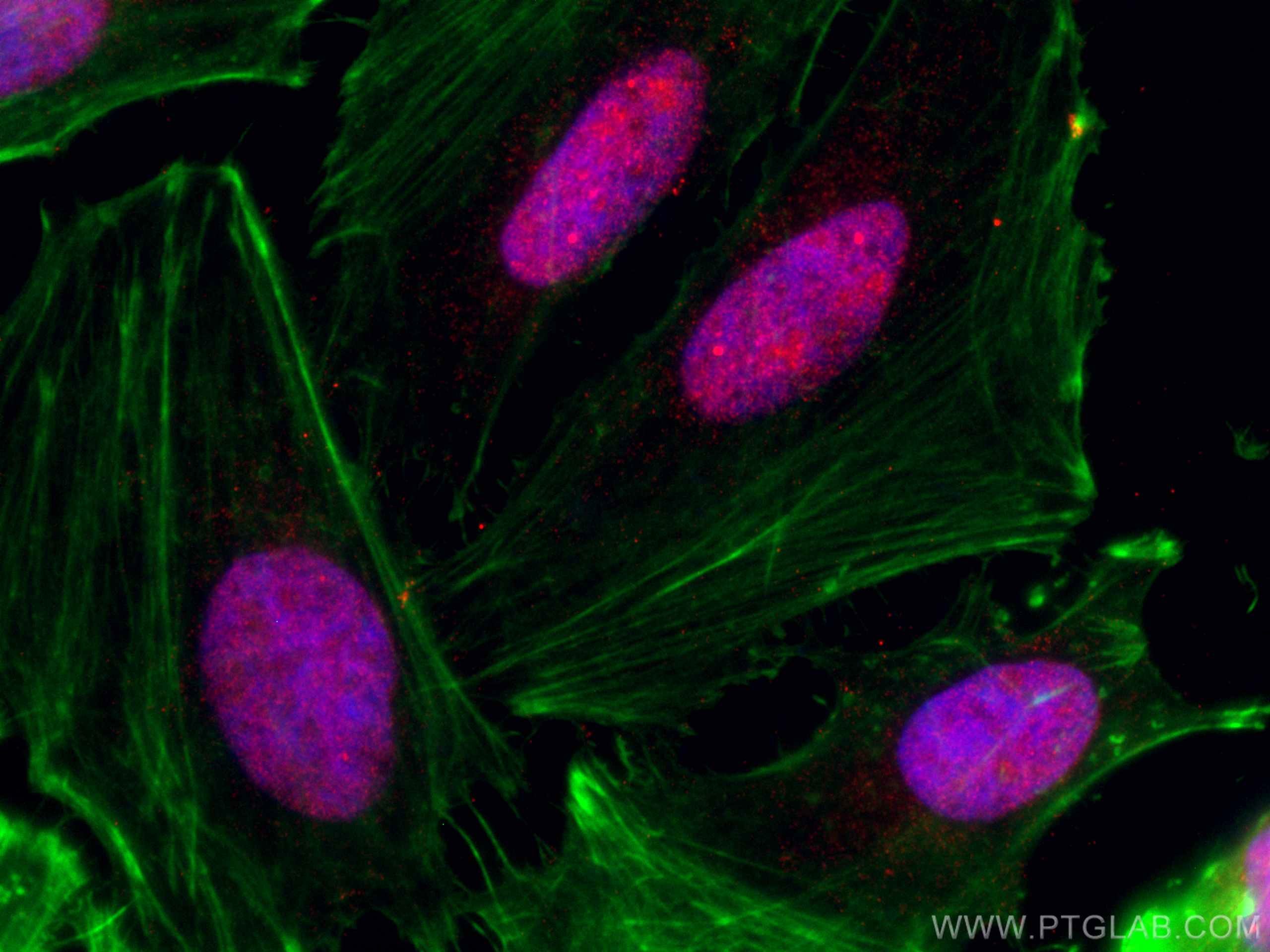 Immunofluorescence (IF) / fluorescent staining of HeLa cells using CoraLite®594-conjugated CHD4 Monoclonal antibody (CL594-66222)
