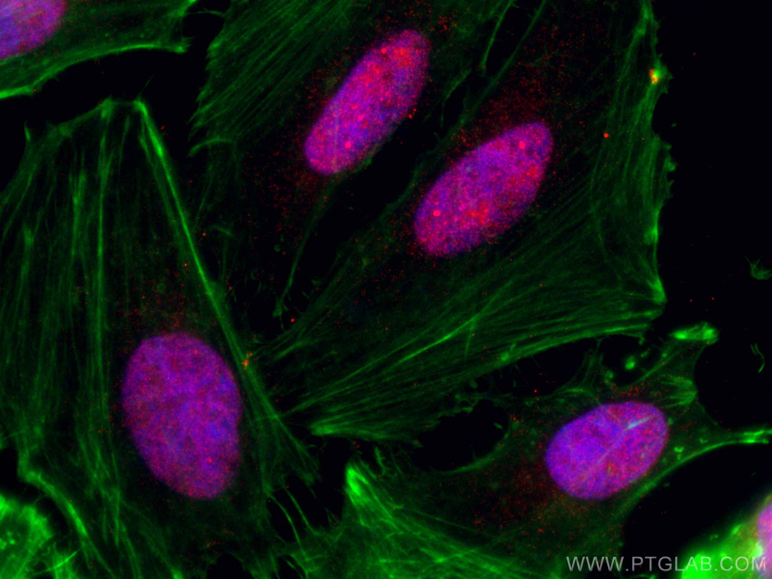 IF Staining of HeLa using CL594-66222