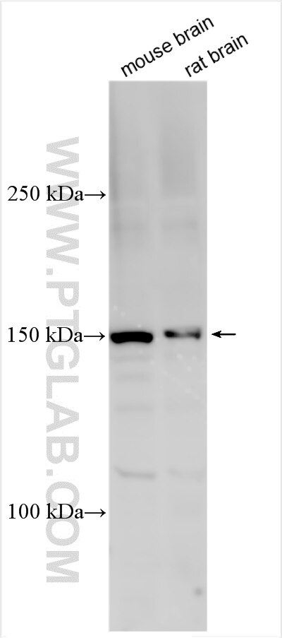 Western Blot (WB) analysis of various lysates using CHD5 Polyclonal antibody (22725-1-AP)