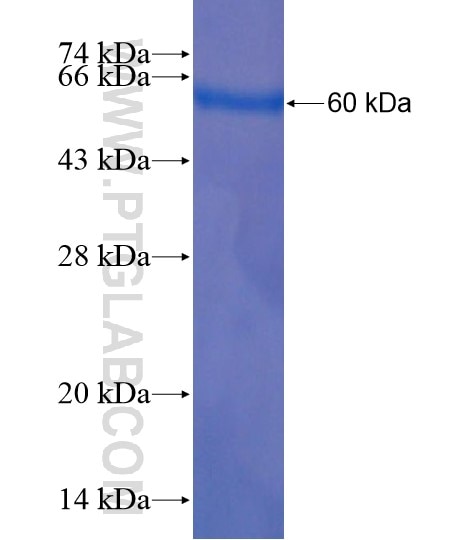 CHD5 fusion protein Ag18621 SDS-PAGE