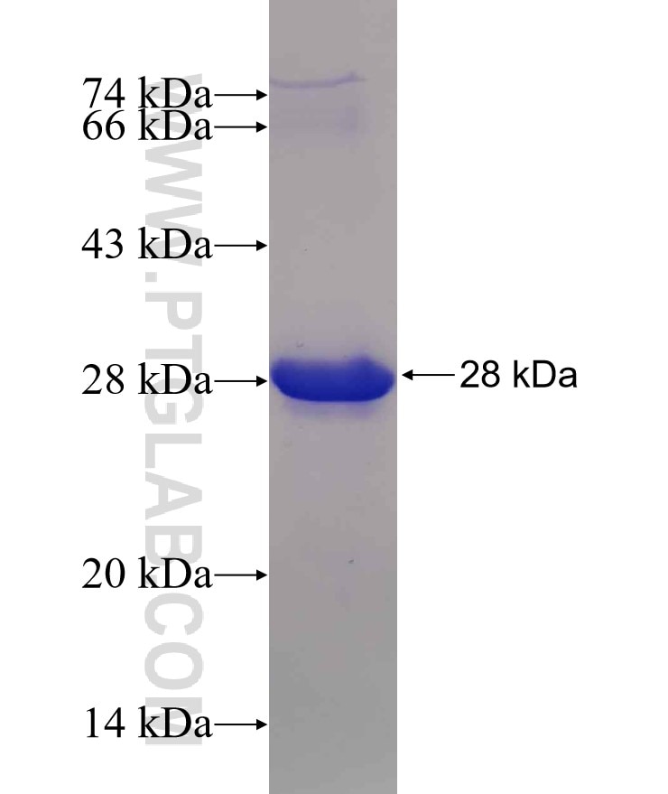CHD5 fusion protein Ag18837 SDS-PAGE
