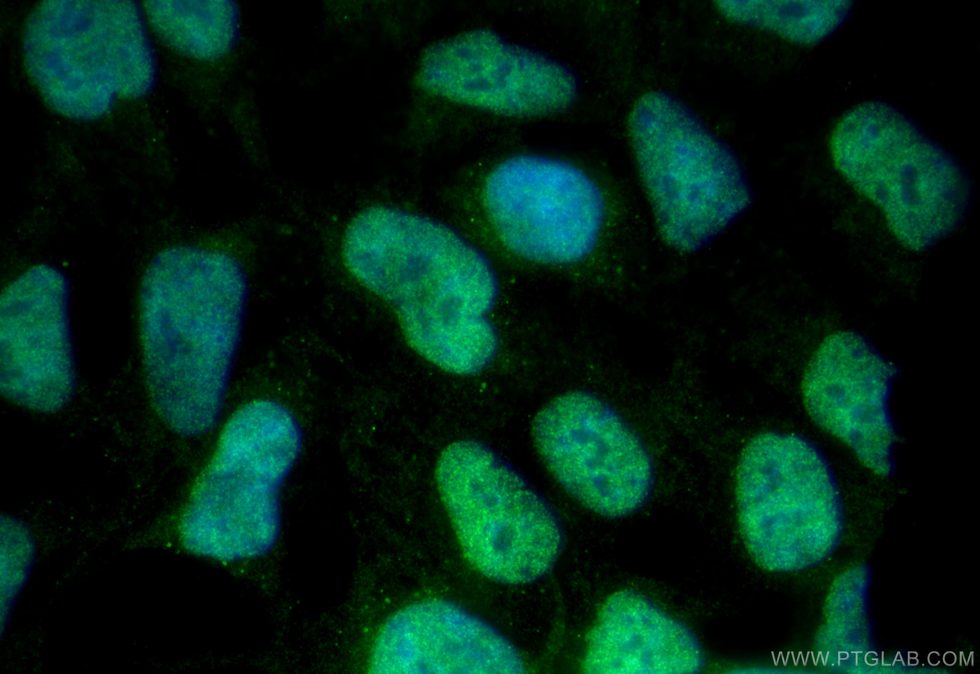 Immunofluorescence (IF) / fluorescent staining of HEK-293 cells using CHD7 Polyclonal antibody (31919-1-AP)