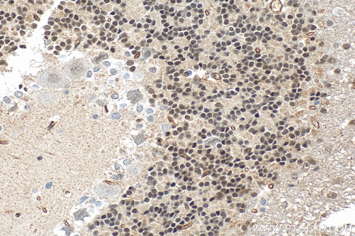 Immunohistochemistry (IHC) staining of rat cerebellum tissue using CHD7 Polyclonal antibody (31919-1-AP)