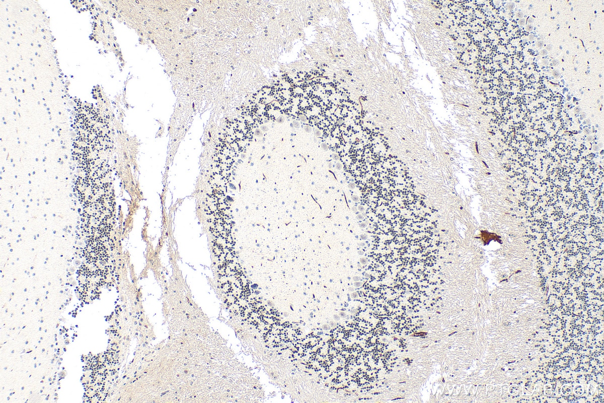 Immunohistochemistry (IHC) staining of mouse cerebellum tissue using CHD7 Polyclonal antibody (31919-1-AP)