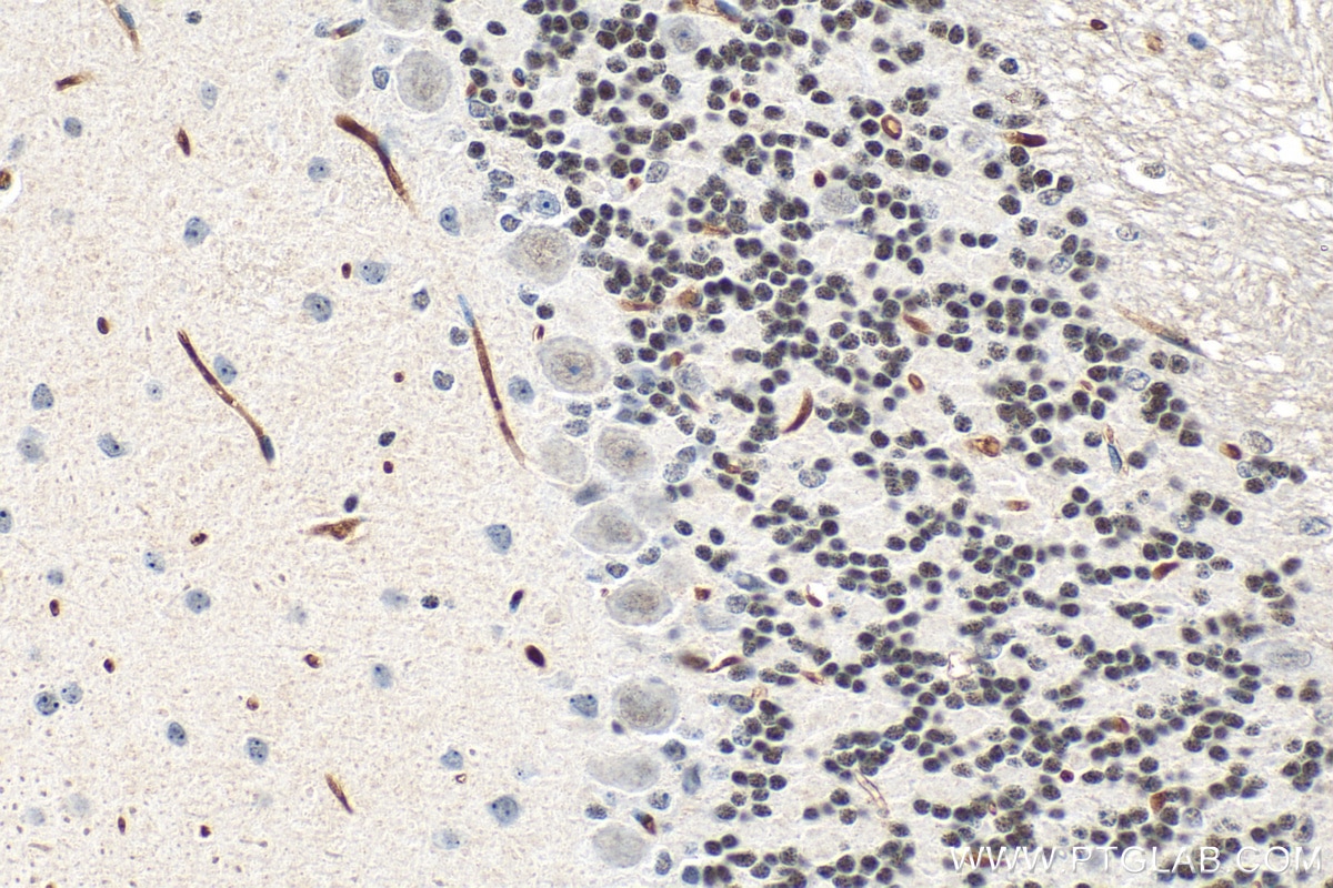 Immunohistochemistry (IHC) staining of mouse cerebellum tissue using CHD7 Polyclonal antibody (31919-1-AP)