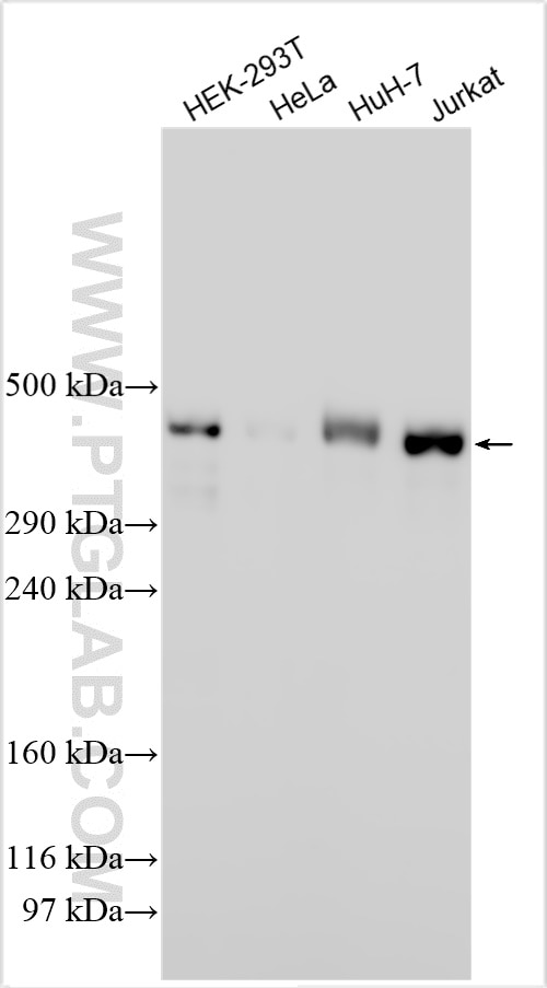 Western Blot (WB) analysis of various lysates using CHD7 Polyclonal antibody (31919-1-AP)