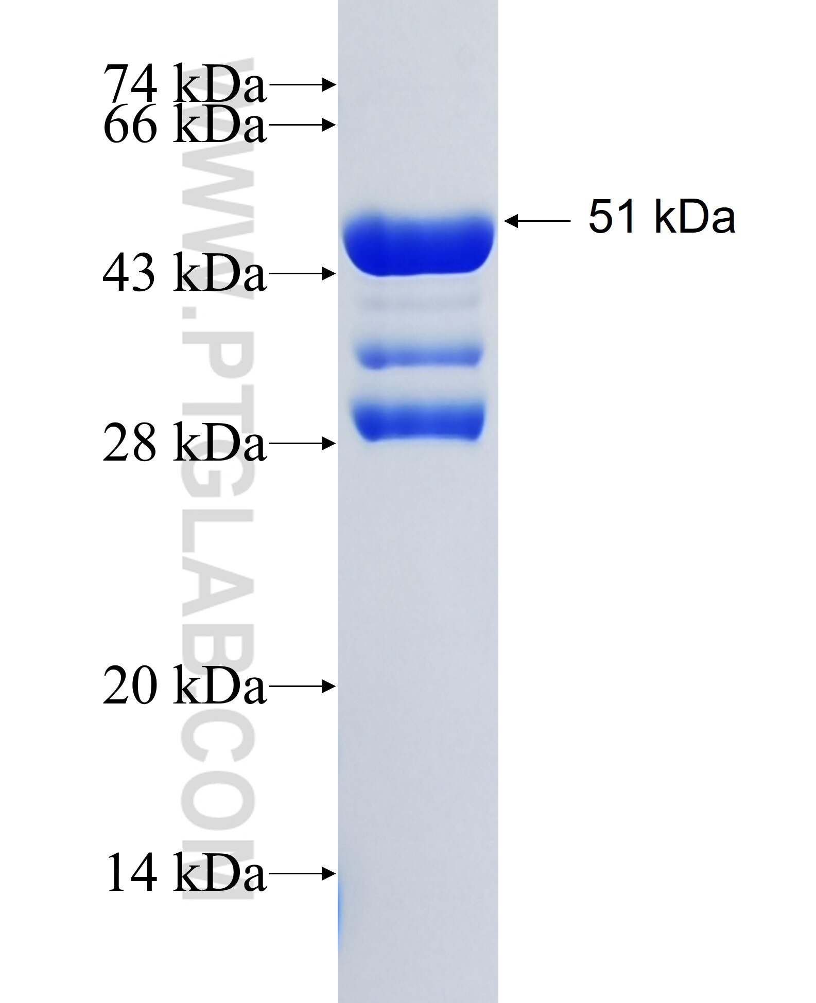 CHD7 fusion protein Ag36595 SDS-PAGE