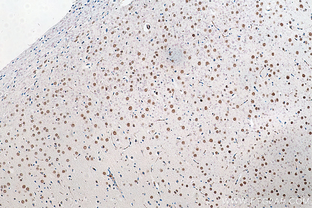 IHC staining of mouse brain using 29783-1-AP