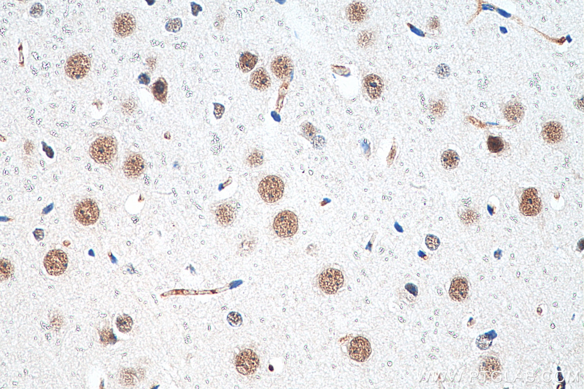 Immunohistochemistry (IHC) staining of mouse brain tissue using CHD8 Polyclonal antibody (29783-1-AP)