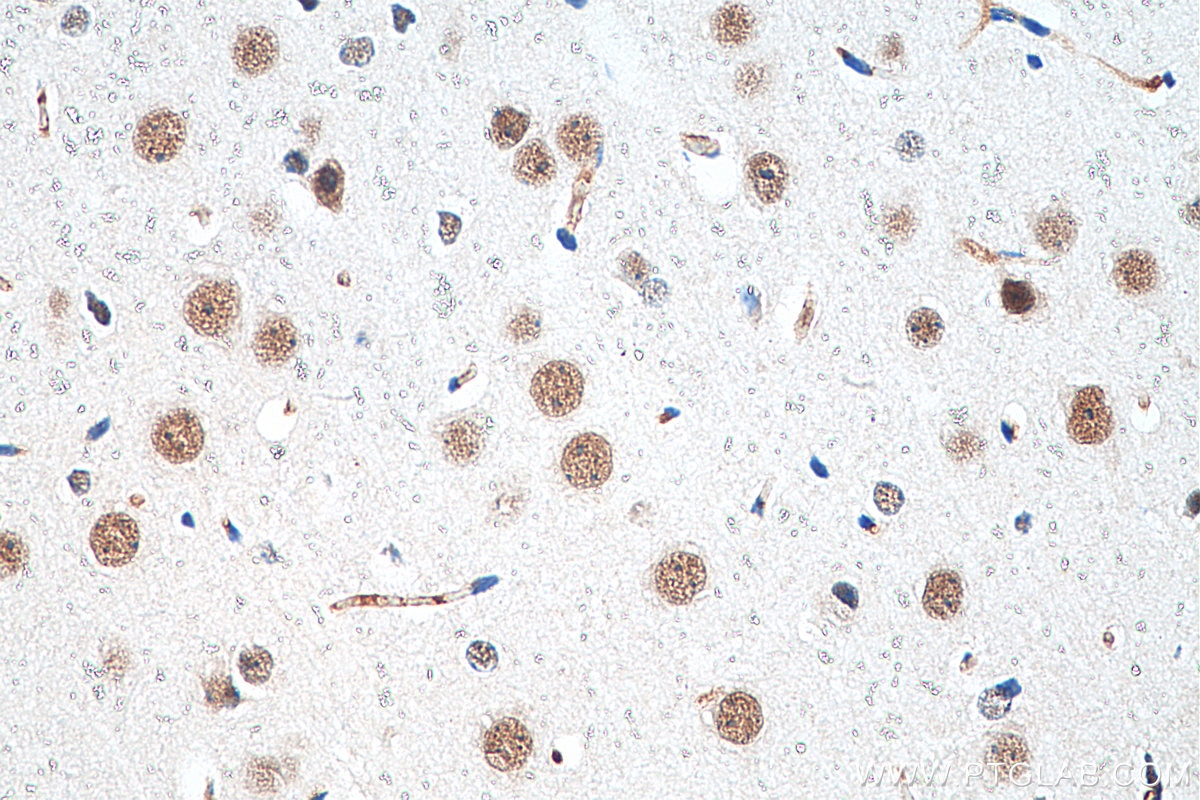 Immunohistochemistry (IHC) staining of mouse brain tissue using CHD8 Polyclonal antibody (29783-1-AP)