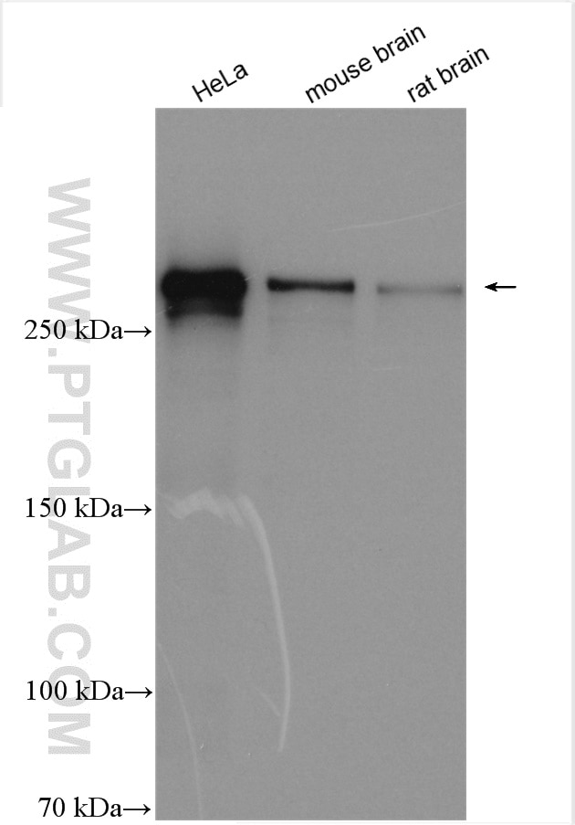 Western Blot (WB) analysis of various lysates using CHD8 Polyclonal antibody (29783-1-AP)